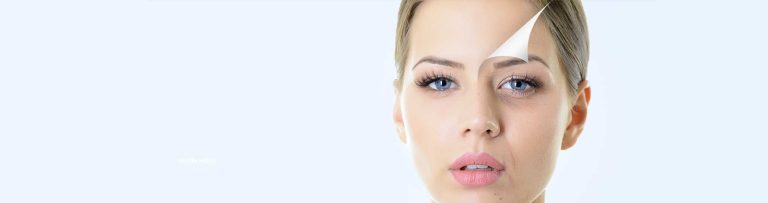 Parotidectomy and Facelift at Alpha Surgical Group